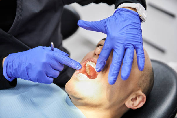 Best Broken or Chipped Tooth Repair in Conway, SC